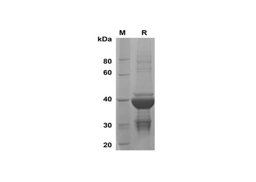 SDS-PAGE analysis of Mouse Agrp proteins, 2 μg/lane of Recombinant Mouse Agrp proteins was resolved with SDS-PAGE under reducing conditions, showing bands at 38 kDa.
