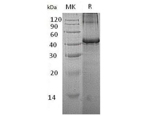 Recombinant Human Testin/TES Protein (His Tag) - ABMIUM