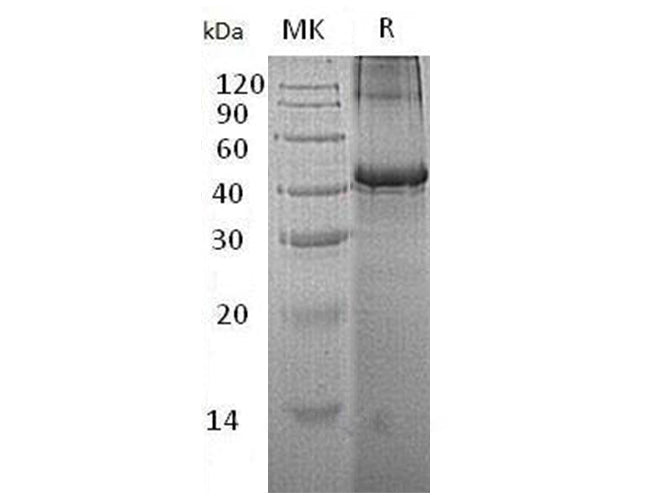 Recombinant Human Testin/TES Protein (His Tag) - ABMIUM
