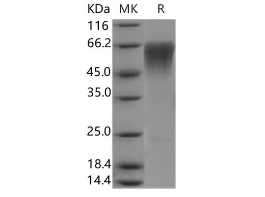 Recombinant Human CLM-9/TREM4 Protein - ABMIUM