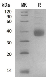 Recombinant Human NACHRA5/CHRNA5 Protein (His Tag) - ABMIUM