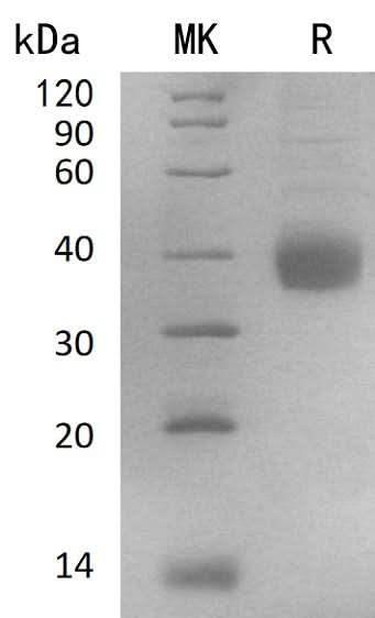 Recombinant Human NACHRA5/CHRNA5 Protein (His Tag) - ABMIUM