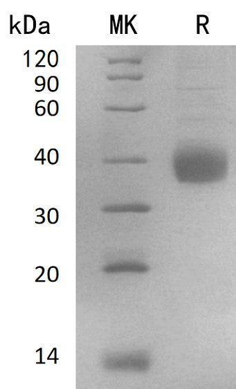 Recombinant Human NACHRA5/CHRNA5 Protein (His Tag) - ABMIUM