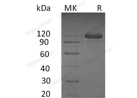 Recombinant Human SEMA4B Protein (His & Fc Tag) - ABMIUM