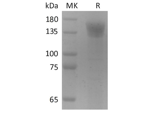 Recombinant SARS-CoV-2 S1 Protein (Fc Tag) - ABMIUM