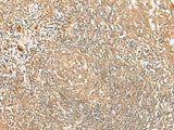 Immunohistochemistry of paraffin-embedded Human tonsil tissue using PROKR1 Polyclonal Antibody at dilution of 1:40(×200)