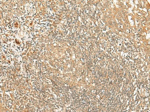 Immunohistochemistry of paraffin-embedded Human tonsil tissue using PROKR1 Polyclonal Antibody at dilution of 1:40(×200)