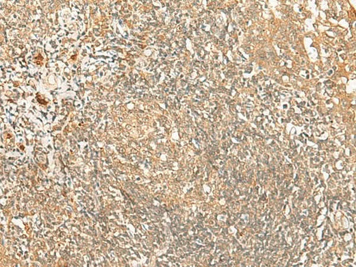 Immunohistochemistry of paraffin-embedded Human tonsil tissue using PROKR1 Polyclonal Antibody at dilution of 1:40(×200)