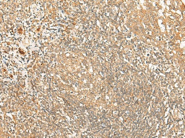 Immunohistochemistry of paraffin-embedded Human tonsil tissue using PROKR1 Polyclonal Antibody at dilution of 1:40(×200)