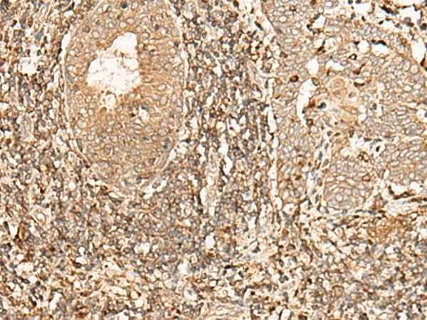 Anti-Human/Mouse/Rat GALR2 Antibody