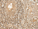 Anti-Human/Mouse/Rat GALR2 Antibody - ABMIUM
