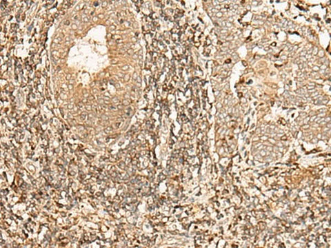 Anti-Human/Mouse/Rat GALR2 Antibody - ABMIUM