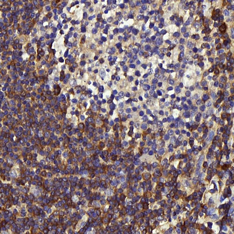 Immunohistochemistry analysis of paraffin-embedded human tonsil using c-Kit Polyclonal Antibody at dilution of 1:200.