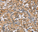 Anti-Human/Mouse FLT3 Antibody - ABMIUM