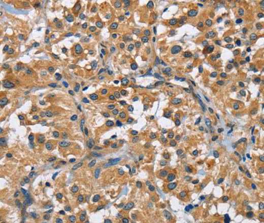 Anti-Human/Mouse FLT3 Antibody