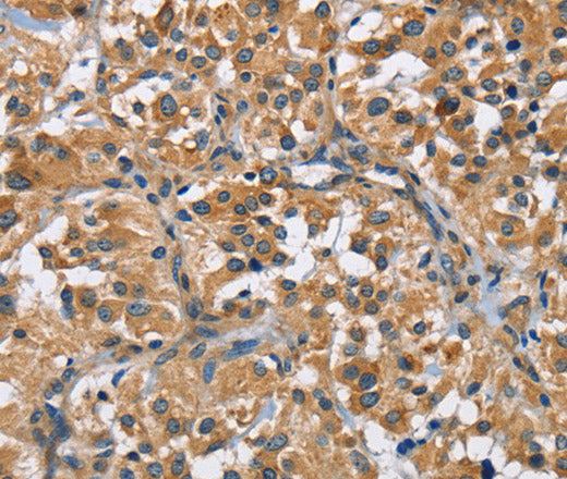 Anti-Human/Mouse FLT3 Antibody - ABMIUM