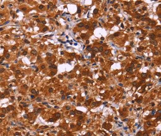 Anti-Human/Mouse ART5 Antibody