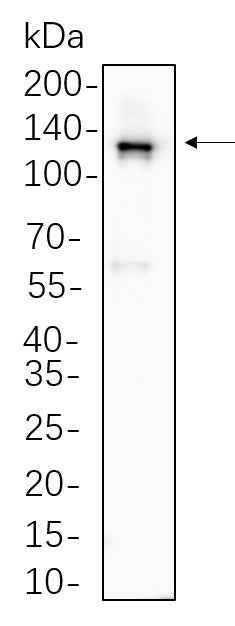 Anti-Human/Mouse/Rat Vinculin Antibody [B632] - ABMIUM