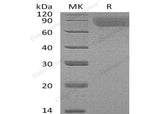 Recombinant Human Thrombopoietin/TPO Protein (His Tag) - ABMIUM
