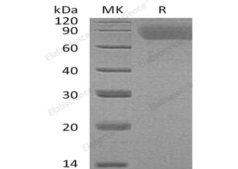 Recombinant Human Thrombopoietin/TPO Protein (His Tag) - ABMIUM