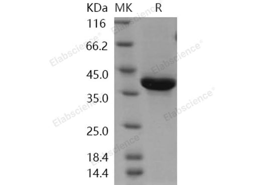 > 86 % as determined by reducing SDS-PAGE.