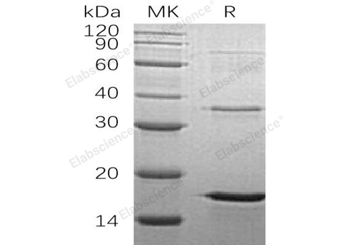 Recombinant Human LSM4 Protein (His Tag) - ABMIUM