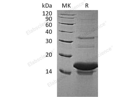 Recombinant Human Tachykinin-3/TAC3 Protein (His Tag) - ABMIUM