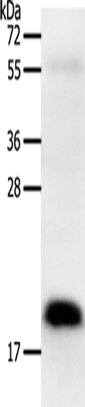 Anti-Human/Mouse/Rat PTN Antibody - ABMIUM