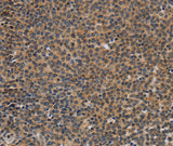 Anti-Human TNFRSF8 Antibody - ABMIUM