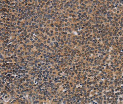 Anti-Human TNFRSF8 Antibody - ABMIUM