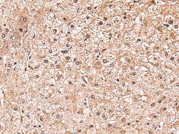 Anti-Human RUSC1 Antibody