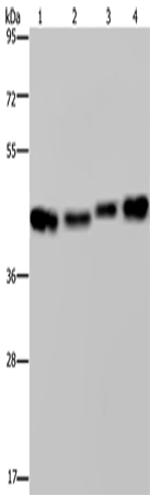 Anti-Human/Mouse/Rat DNAJA1 Antibody - ABMIUM