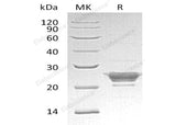Recombinant Human Peroxiredoxin-3/PRDX3 Protein - ABMIUM