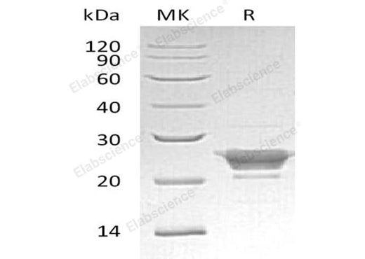 Recombinant Human Peroxiredoxin-3/PRDX3 Protein - ABMIUM