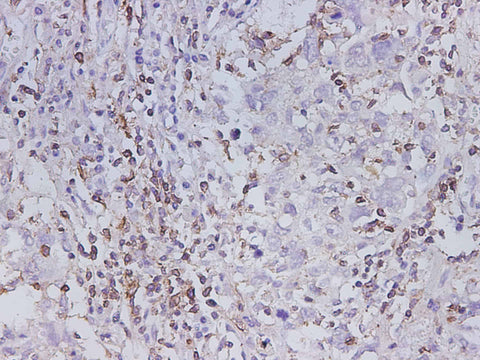 Anti-Human MMP-1 Antibody - ABMIUM