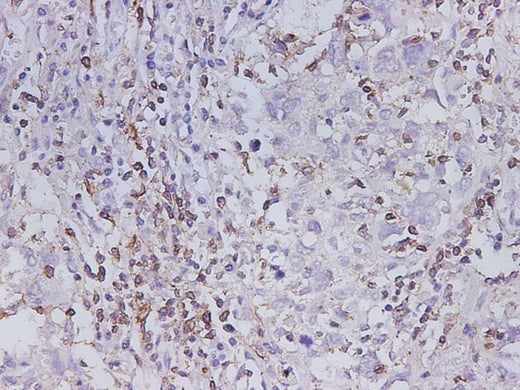Anti-Human MMP-1 Antibody - ABMIUM