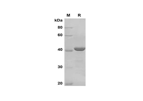 SDS-PAGE analysis of Human TGFB1 proteins, 2 μg/lane of Recombinant Human TGFB1 proteins was resolved with SDS-PAGE under reducing conditions, showing bands at 40 kDa.
