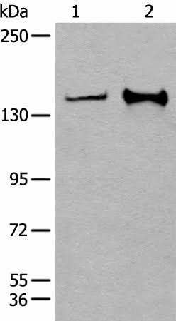 Anti-Human/Mouse CAPN15 Antibody - ABMIUM