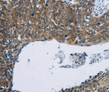 Anti-Human/Mouse/Rat KPNB1 Antibody - ABMIUM