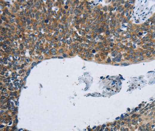 Anti-Human/Mouse/Rat KPNB1 Antibody