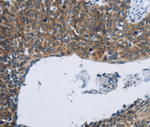 Anti-Human/Mouse/Rat KPNB1 Antibody - ABMIUM