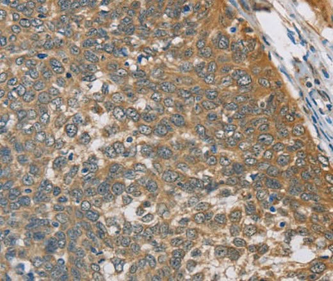 Anti-Human TNFRSF10D Antibody - ABMIUM