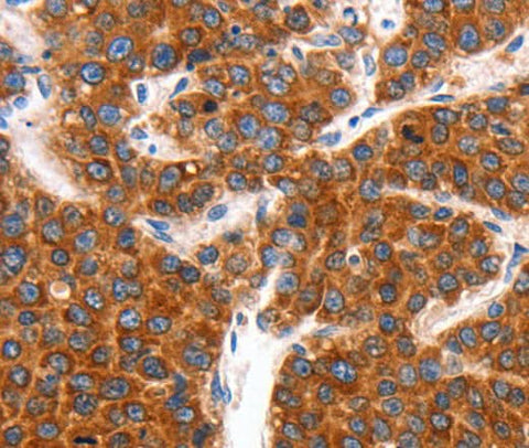 Anti-Human/Mouse/Rat KCNC2 Antibody - ABMIUM
