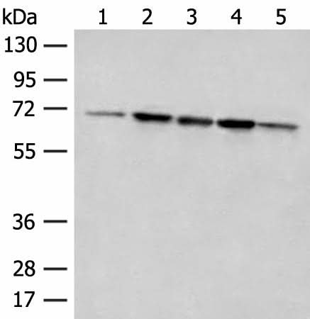 Western blot analysis of 293T cell Rat liver tissue A172 and Jurkat cell lysates using ACSF2 Polyclonal Antibody at dilution of 1:400