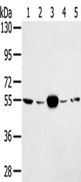 Anti-Human TRIM35 Antibody - ABMIUM