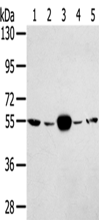Anti-Human TRIM35 Antibody - ABMIUM