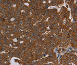 Anti-Human/Rat HSD17B13 Antibody - ABMIUM