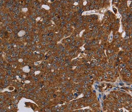 Anti-Human/Rat HSD17B13 Antibody