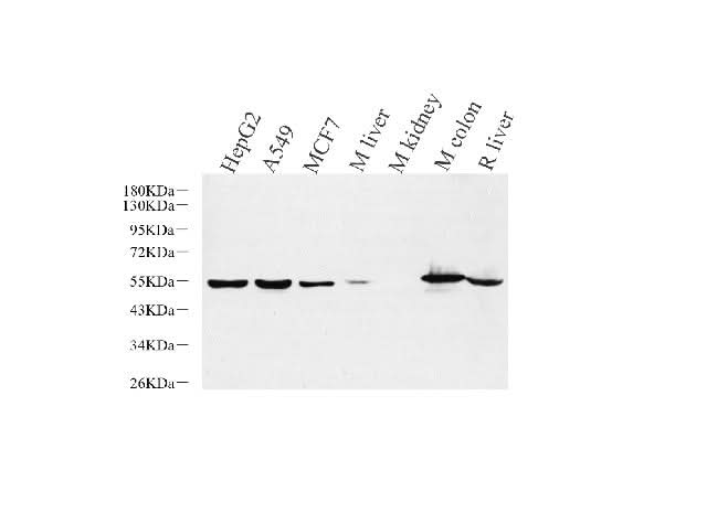 Western Blot analysis of various samples using CK-8 Polyclonal Antibody at dilution of 1:1000.