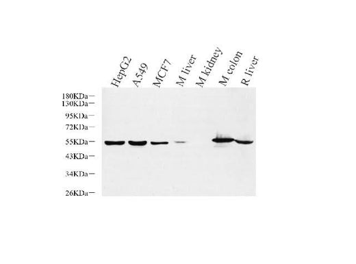 Western Blot analysis of various samples using CK-8 Polyclonal Antibody at dilution of 1:1000.